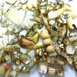 Ankauf Zahngold Dentalgold Degulor Zahnkronen
